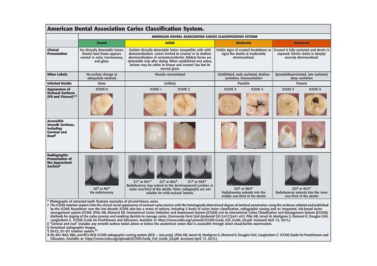 Dental Caries: An Update On Dental Trends And Therapy | University Of ...